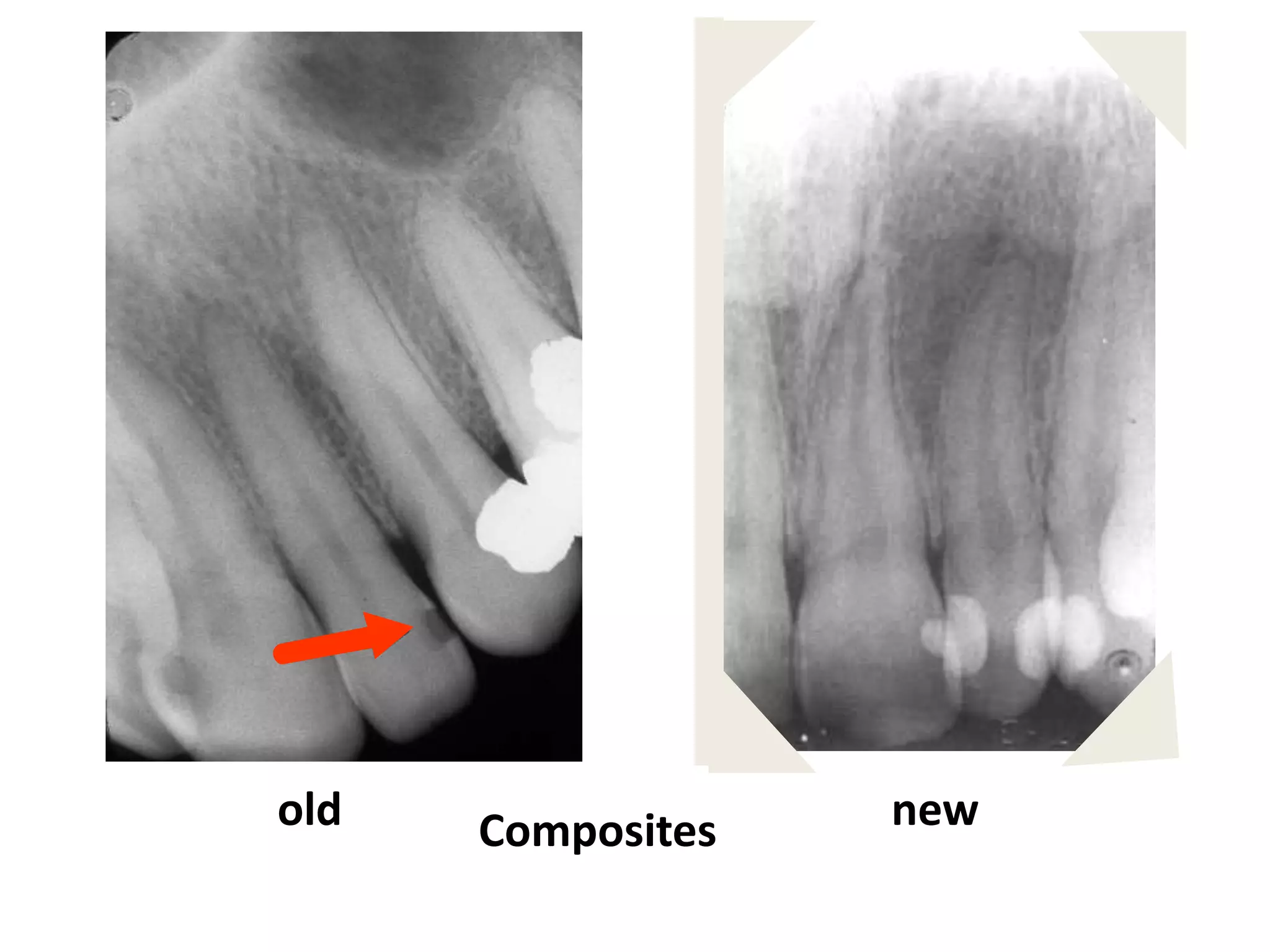 old   Composites   new
 