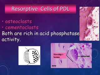 Resorptive Cells of PDL
• osteoclasts
• cementoclasts
Both are rich in acid phosphatase
activity.
 