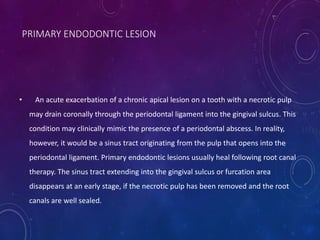 • An acute exacerbation of a chronic apical lesion on a tooth with a necrotic pulp
may drain coronally through the periodontal ligament into the gingival sulcus. This
condition may clinically mimic the presence of a periodontal abscess. In reality,
however, it would be a sinus tract originating from the pulp that opens into the
periodontal ligament. Primary endodontic lesions usually heal following root canal
therapy. The sinus tract extending into the gingival sulcus or furcation area
disappears at an early stage, if the necrotic pulp has been removed and the root
canals are well sealed.
PRIMARY ENDODONTIC LESION
 