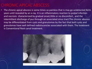 CHRONIC APICAL ABSCESS
• The chronic apical abscess is some times so painless that is may go undetected form
years until revealed by an x-ray .It is an inflammatory reaction to pulpal infection
and necrosis characterized by gradual onset,little or no discomfort , and the
intermittent discharge of pus through an associated sinus tract.The chronic abscess
may be differentiated from cysts and granulomas by the fact that both cysts and
granulomas have well defined radiolucencies associated with them. The treatment
is Conventional Root canal treatment.
 