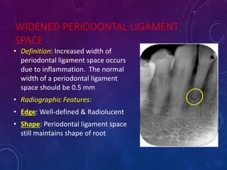 WIDENED PERIODONTAL LIGAMENT
SPACE
• Definition: Increased width of
periodontal ligament space occurs
due to inflammation. The normal
width of a periodontal ligament
space should be 0.5 mm
• Radiographic Features:
• Edge: Well-defined & Radiolucent
• Shape: Periodontal ligament space
still maintains shape of root
 