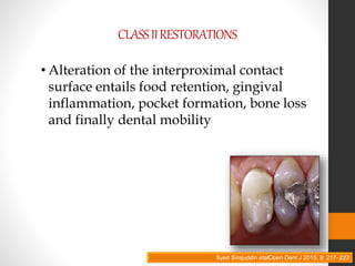 CLASSIIRESTORATIONS
• Alteration of the interproximal contact
surface entails food retention, gingival
inflammation, pocket formation, bone loss
and finally dental mobility
Syed Sirajuddin etalOpen Dent J 2015; 9: 217–222
 