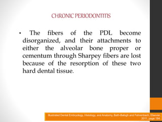 CHRONICPERIODONTITIS
• The fibers of the PDL become
disorganized, and their attachments to
either the alveolar bone proper or
cementum through Sharpey fibers are lost
because of the resorption of these two
hard dental tissue.
Illustrated Dental Embryology, Histology, and Anatomy, Bath-Balogh and Fehrenbach, Elsevier,
2011, page 184.
 