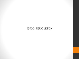 ENDO- PERIO LESION
 