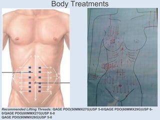 Body Treatments
Recommended Lifting Threads: QAGE PDO(50MMX27G)USP 5-0/QAGE PDO(60MMX29G)USP 6-
0/QAGE PDO(60MMX27G)USP 6-0
QAGE PDO(90MMX26G)USP 5-0
 