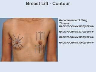 Recommended Lifting
Threads:
QAGE PDO(38MMX27G)USP 6-0
QAGE PDO(50MMX27G)USP 5-0
QAGE PDO(60MMX27G)USP 6-0
QAGE PDO(90MMX26G)USP 5-0
Breast Lift - Contour
 