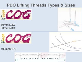 PDO Lifting Threads Types & Sizes
60mmx23G
90mmx23G
100mmx19G
 