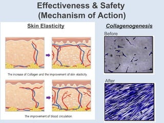 Before
After
Collagenogenesis
Effectiveness & Safety
(Mechanism of Action)
Skin Elasticity
 