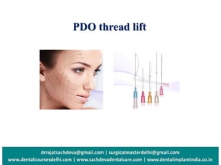 PDO thread lift
 