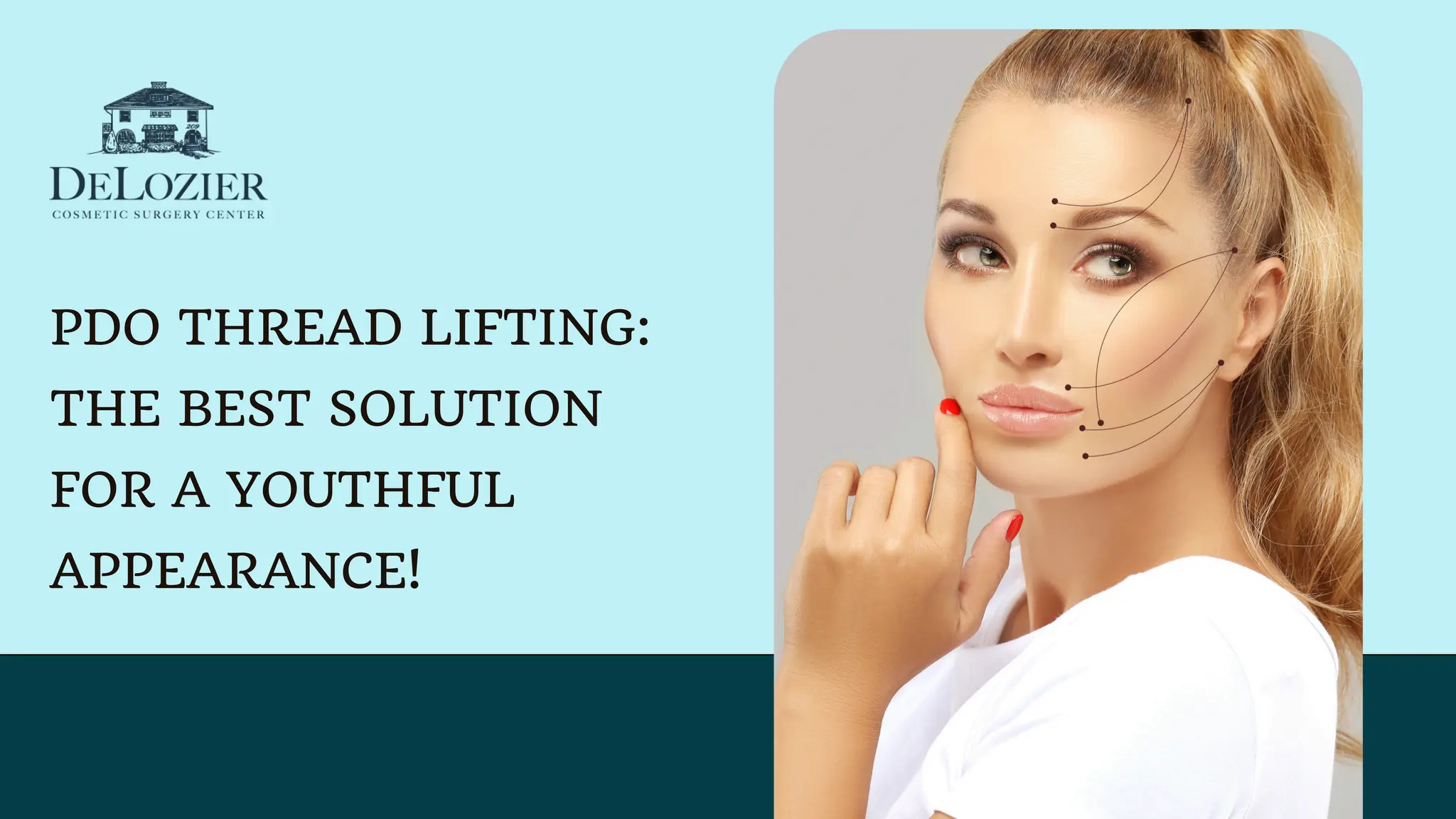 PDO Thread Lifting: The Best Solution for a Youthful Appearance! | PDF