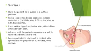  Technique :
 Have the patient lie in supine in a sniffing
position.
 Soak a long cotton tipped applicator in local
anaesthetic (2-4% lidocaine, 0.5% ropivacaine, or
0.5% bupivacaine).
 Insert cotton tipped applicator into patients Nare
aiming straight back.
 Advance until the posterior nasopharynx wall is
reached and resistance is felt.
 Leave applicator in place and in contact with
sphenopalatine ganglion for 10 minutes, then
remove.
 