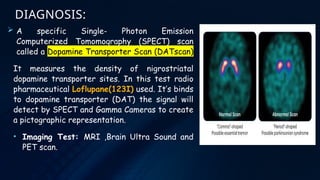 Overview of Parkinson’s disease :- Etiology, types, pathogenesis,signs ...