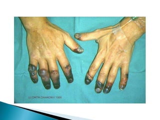 pdpt ruido proxima aula 3008.pdf