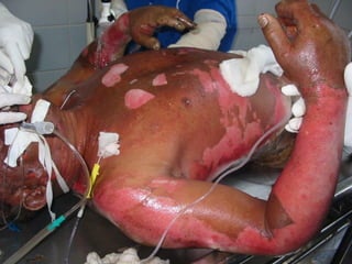 pdpt ruido proxima aula 3008.pdf