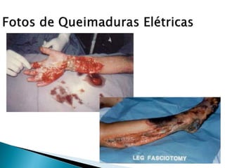 pdpt ruido proxima aula 3008.pdf