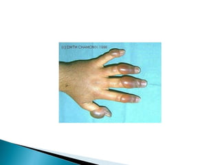 pdpt ruido proxima aula 3008.pdf