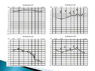 pdpt ruido proxima aula 3008.pdf