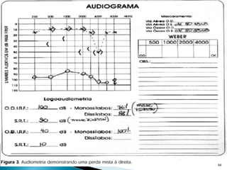 pdpt ruido proxima aula 3008.pdf