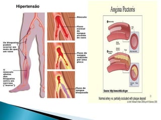 pdpt ruido proxima aula 3008.pdf