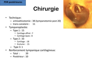 PDR postérieures


                                  Chirurgie
 • Technique:
     – antroatticotomie : 38 (tympanotomie post 20)
     – trans-canalaire : 11
 • Tympanoplastie:
     – Type 1 : 15
         • Cartilage affiné : 7
         • Cartilage épais : 8
     – Type 2 : 33
         • Cartilage : 18
         • Enclume : 15
     – Type 3: 1
 • Renforcement tympanique cartilagineux:
     – Total :      39
     – Postérieur : 10
 