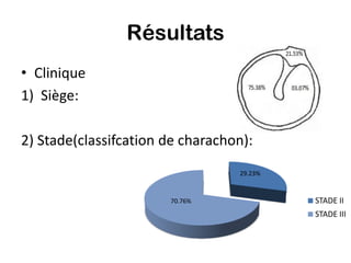 Résultats
• Clinique
1) Siège:

2) Stade(classifcation de charachon):
                                  29.23%



                       70.76%              STADE II
                                           STADE III
 