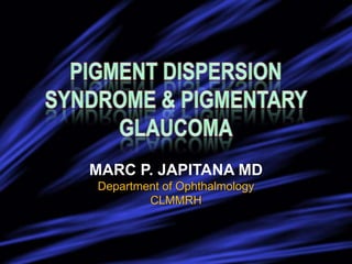 MARC P. JAPITANA MD
Department of Ophthalmology
        CLMMRH
 