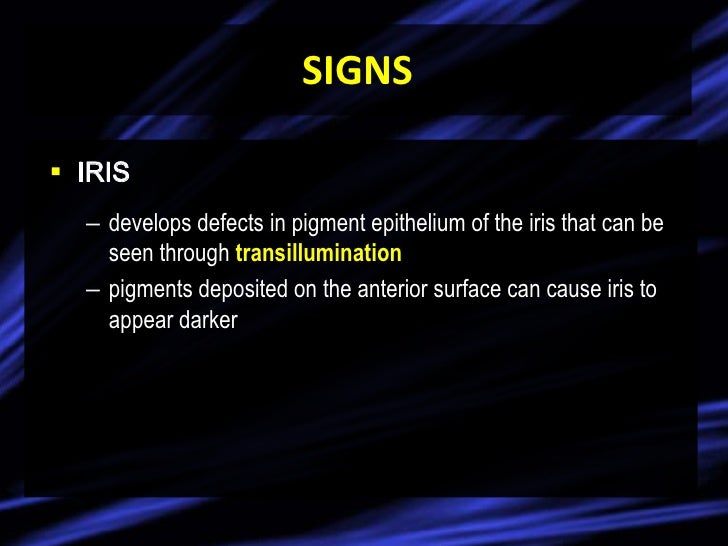 Pigment Dispersion Syndrome & Pigmentary