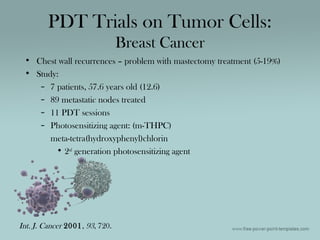 • Chest wall recurrences – problem with mastectomy treatment (5-19%)
• Study:
– 7 patients, 57.6 years old (12.6)
– 89 metastatic nodes treated
– 11 PDT sessions
– Photosensitizing agent: (m-THPC)
meta-tetra(hydroxyphenyl)chlorin
• 2nd
generation photosensitizing agent
PDT Trials on Tumor Cells:
Breast Cancer
Int. J. Cancer 2001, 93, 720.
 