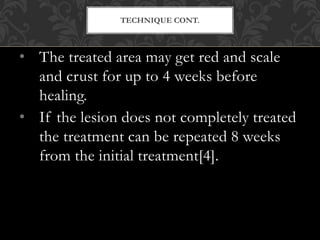 • The treated area may get red and scale
and crust for up to 4 weeks before
healing.
• If the lesion does not completely treated
the treatment can be repeated 8 weeks
from the initial treatment[4].
TECHNIQUE CONT.
 