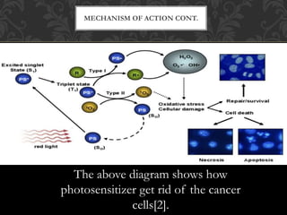 MECHANISM OF ACTION CONT.
The above diagram shows how
photosensitizer get rid of the cancer
cells[2].
 