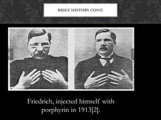 BRIEF HISTORY CONT.
Friedrich, injected himself with
porphyrin in 1913[2].
 