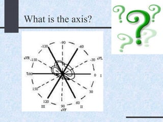 What is the axis?
 