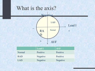 What is the axis?
LAD
Normal
RA
D
Lead I
AVF
Negative
+
+
_
Lead I AVF
Normal Positive Positive
RAD Negative Positive
LAD Negative Negative
 