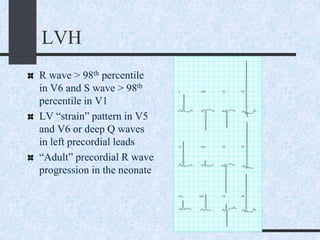 LVH
R wave > 98th percentile
in V6 and S wave > 98th
percentile in V1
LV “strain” pattern in V5
and V6 or deep Q waves
in left precordial leads
“Adult” precordial R wave
progression in the neonate
 