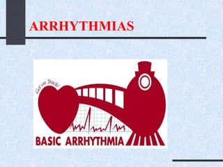ARRHYTHMIAS
 
