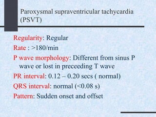 Paroxysmal supraventricular tachycardia
(PSVT)
Regularity: Regular
Rate : >180/min
P wave morphology: Different from sinus P
wave or lost in preceeding T wave
PR interval: 0.12 – 0.20 secs ( normal)
QRS interval: normal (<0.08 s)
Pattern: Sudden onset and offset
 