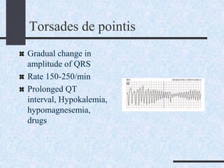 Torsades de pointis
Gradual change in
amplitude of QRS
Rate 150-250/min
Prolonged QT
interval, Hypokalemia,
hypomagnesemia,
drugs
 