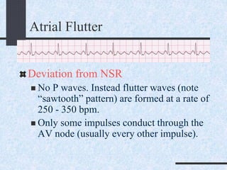 Atrial Flutter
Deviation from NSR
 No P waves. Instead flutter waves (note
“sawtooth” pattern) are formed at a rate of
250 - 350 bpm.
 Only some impulses conduct through the
AV node (usually every other impulse).
 