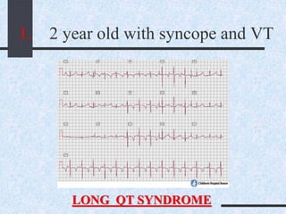 1. 2 year old with syncope and VT
LONG QT SYNDROME
 