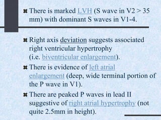 There is marked LVH (S wave in V2 > 35
mm) with dominant S waves in V1-4.
Right axis deviation suggests associated
right ventricular hypertrophy
(i.e. biventricular enlargement).
There is evidence of left atrial
enlargement (deep, wide terminal portion of
the P wave in V1).
There are peaked P waves in lead II
suggestive of right atrial hypertrophy (not
quite 2.5mm in height).
 