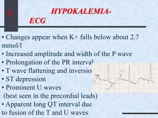 • Changes appear when K+ falls below about 2.7
mmol/l
• Increased amplitude and width of the P wave
• Prolongation of the PR interval
• T wave flattening and inversion
• ST depression
• Prominent U waves
(best seen in the precordial leads)
• Apparent long QT interval due
to fusion of the T and U waves
HYPOKALEMIA-
ECG
5.
 