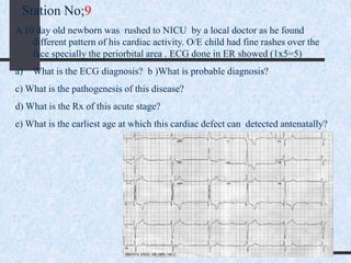 Station No;9
A 10 day old newborn was rushed to NICU by a local doctor as he found
different pattern of his cardiac activity. O/E child had fine rashes over the
face specially the periorbital area . ECG done in ER showed (1x5=5)
a) What is the ECG diagnosis? b )What is probable diagnosis?
c) What is the pathogenesis of this disease?
d) What is the Rx of this acute stage?
e) What is the earliest age at which this cardiac defect can detected antenatally?
 