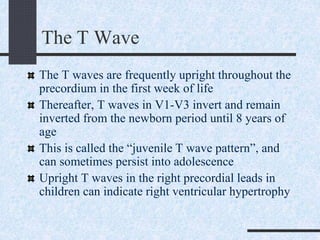 The T Wave
The T waves are frequently upright throughout the
precordium in the first week of life
Thereafter, T waves in V1-V3 invert and remain
inverted from the newborn period until 8 years of
age
This is called the “juvenile T wave pattern”, and
can sometimes persist into adolescence
Upright T waves in the right precordial leads in
children can indicate right ventricular hypertrophy
 