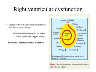 Right ventricular dysfunction
• Increased RV wall tension also compresses
the right coronary artery
diminished subendocardial perfusion
limits myocardial oxygen supply
myocardial ischemia and RV infarction
 