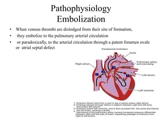 Pathophysiology
Embolization
• When venous thrombi are dislodged from their site of formation,
• they embolize to the pulmonary arterial circulation
• or paradoxically, to the arterial circulation through a patent foramen ovale
or atrial septal defect
 