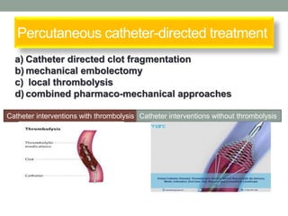 Percutaneous catheter-directed treatment
Catheter interventions with thrombolysis Catheter interventions without thrombolysis
a) Catheter directed clot fragmentation
b) mechanical embolectomy
c) local thrombolysis
d) combined pharmaco-mechanical approaches
 