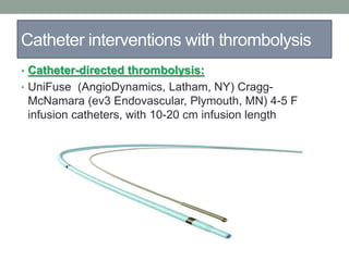 Catheter interventions with thrombolysis
• Catheter-directed thrombolysis:
• UniFuse (AngioDynamics, Latham, NY) Cragg-
McNamara (ev3 Endovascular, Plymouth, MN) 4-5 F
infusion catheters, with 10-20 cm infusion length
 