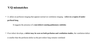 Pulmonary embolism ventilation perfusion scan | PPTX