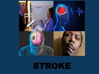 STROKE
 