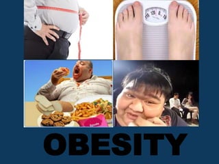 OBESITY
 